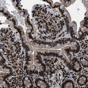Anti-PRKX antibody produced in rabbit 