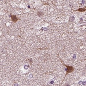 Anti-PRLH antibody produced in rabbit 