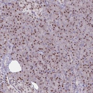 Anti-PRMT6 antibody produced in rabbit 