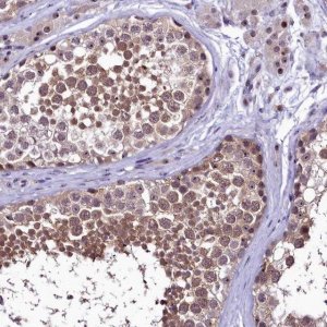 Anti-PRNT antibody produced in rabbit 