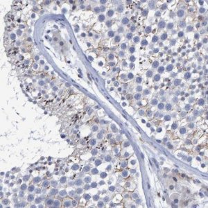 Anti-PROCA1 antibody produced in rabbit 