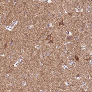 Anti-PROKR2 antibody produced in rabbit 