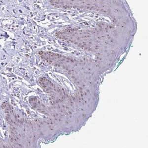 Anti-PROSER1 antibody produced in rabbit 