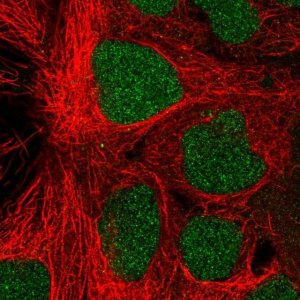 Anti-PROSER1 antibody produced in rabbit 