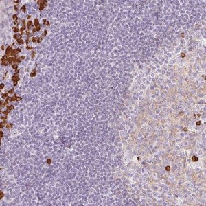 Anti-PRPF38B antibody produced in rabbit HPA053255-100UL