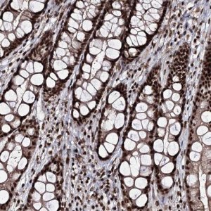 Anti-PRPF40A antibody produced in rabbit 