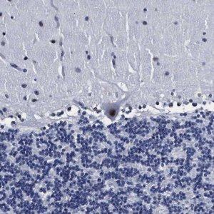 Anti-PRPF4B antibody produced in rabbit 