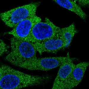 Anti-PRPSAP1 antibody produced in rabbit 