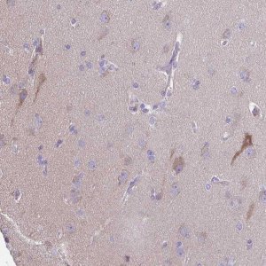Anti-PRR14L antibody produced in rabbit 