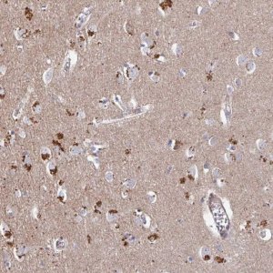 Anti-PRR5 antibody produced in rabbit 