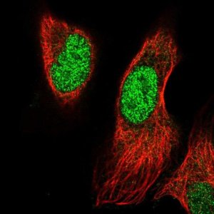Anti-PRRX1 antibody produced in rabbit 