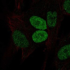Anti-PRRX2 antibody produced in rabbit 