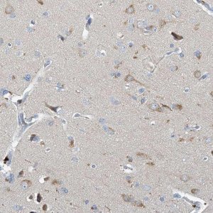Anti-PRSS12 antibody produced in rabbit 