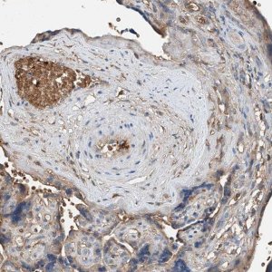 Anti-PRSS23 antibody produced in rabbit 