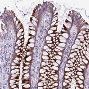 Anti-PRSS45 antibody produced in rabbit 