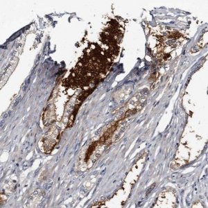 Anti-PRSS8 antibody produced in rabbit 