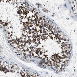 Anti-PRTFDC1 antibody produced in rabbit 