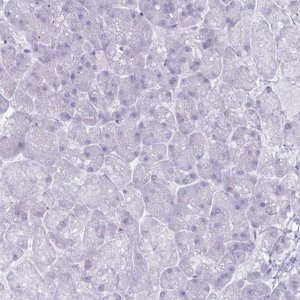 Anti-PSCA antibody produced in rabbit HPA056418-100UL