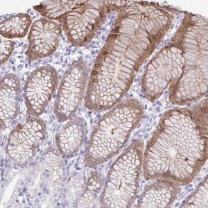 Anti-PSCA antibody produced in rabbit HPA056418-100UL