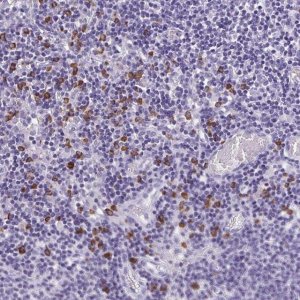 Anti-PSD antibody produced in rabbit 