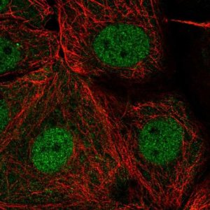 Anti-PSD antibody produced in rabbit 