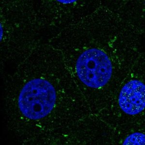 Anti-PSEN1 antibody produced in rabbit 