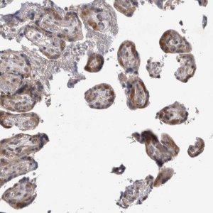 Anti-PSMB2 antibody produced in rabbit 