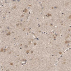 Anti-PSMB2 antibody produced in rabbit 