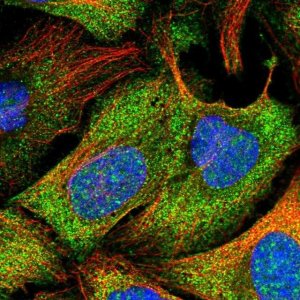 Anti-PSMB9 antibody produced in rabbit 