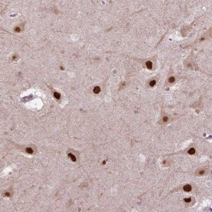 Anti-PSMC2 antibody produced in rabbit 