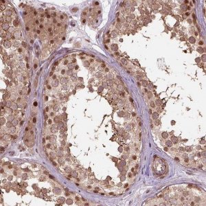 Anti-PSMD11 antibody produced in rabbit HPA067433-100UL