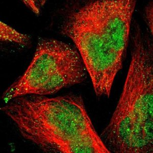 Anti-PSMD14 antibody produced in rabbit 