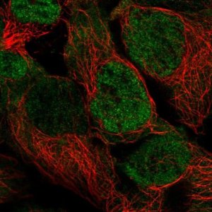 Anti-PSMD3 antibody produced in rabbit 