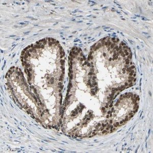 Anti-PSMD5 antibody produced in rabbit 