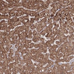 Anti-PSMD6 antibody produced in rabbit 