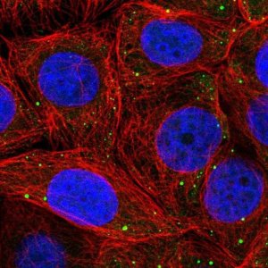 Anti-PSMD6 antibody produced in rabbit 