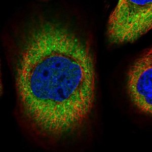 Anti-PSPH antibody produced in rabbit 