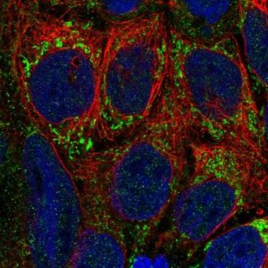 Anti-PTCD1 antibody produced in rabbit 