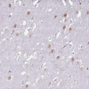 Anti-PTCHD1 antibody produced in rabbit 