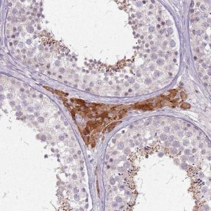 Anti-PTCHD3 antibody produced in rabbit 