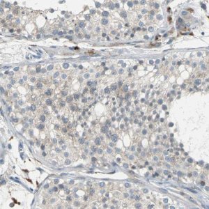 Anti-PTGDS antibody produced in rabbit 