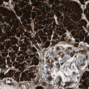 Anti-PTH2R antibody produced in rabbit 