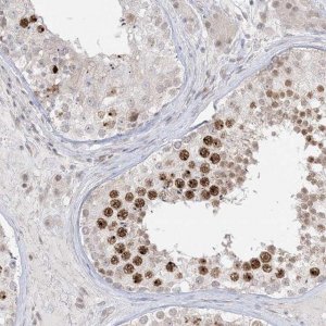 Anti-PTK6 antibody produced in rabbit 