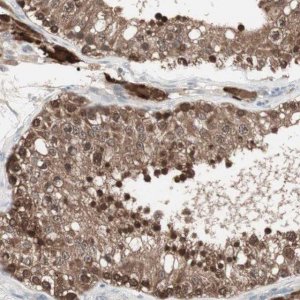 Anti-PTPA antibody produced in rabbit HPA005695-100UL