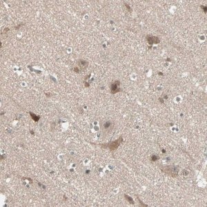 Anti-PTPA antibody produced in rabbit HPA005695-100UL