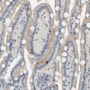 Anti-PTPN4 antibody produced in rabbit HPA019351-100UL