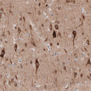 Anti-PTPRD antibody produced in rabbit 