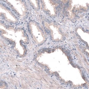 Anti-PTPRK antibody produced in rabbit 