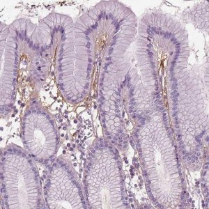Anti-PTX3 antibody produced in rabbit 