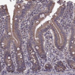 Anti-PUDP antibody produced in rabbit 